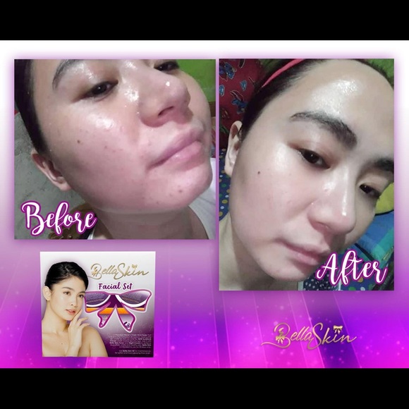 bella skin maintenance set
